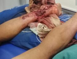 Firman Jaya Halawa  Terancam Biaya Pengobatan Kecelakaan  Kerja, Santunan Kecelakaan Kerja Tidak Dapat dari PT.PHI Langgam