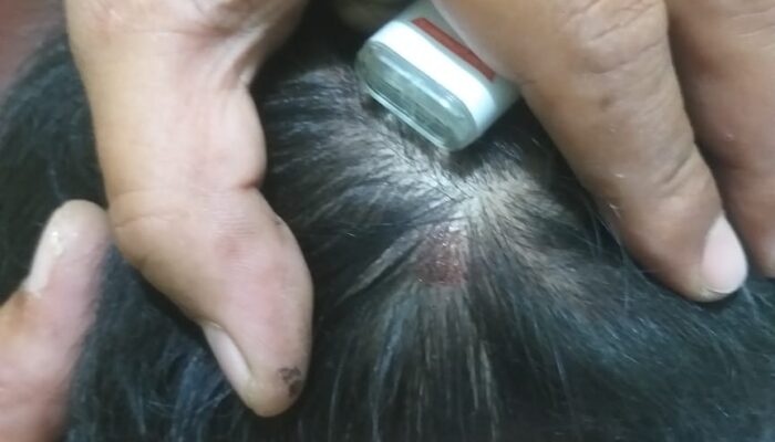 Diduga Ada Keterlibatan R Selaku PJ.Wali Nagari Terkait Merajalelanya Aktifitas Ilegal Mining Diwilayahnya